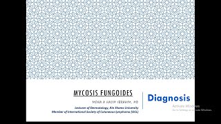 2 Diagnosis of Mycosis Fungoides [upl. by Rayle15]