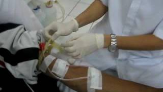 HEMODIALYSIS Procedure [upl. by Bianca]