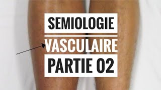 Sémiologie Vasculaire  partie 02 Examen Veineux [upl. by Alleram]