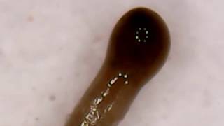 Demodex Mites can someone PLEASE tell me what is going on in this video [upl. by Klara491]