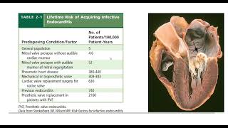 Infective endocarditis  General medicine  DrKarrar Abdulzahra [upl. by Emelen476]