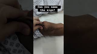 Can You name the sign Neetpg Usmle Neurology tips medicine doctor [upl. by Gnoh]