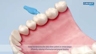 Jak używać szczoteczek międzyzębowych Curasept [upl. by Nirahs40]
