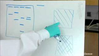 Electrophoresis How to Read Results [upl. by Chucho]