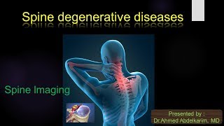 1spine degenerative diseases [upl. by Nnaesor220]