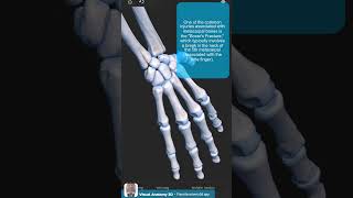 Visual Anatomy 3D  Facts about the Metacarpal bones [upl. by Jo Ann]