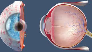 Ophthalmology Cataract surgery  part 2 [upl. by Athalla]