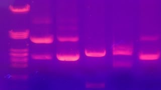 Agarose Gel Electrophoresis  Amrita University [upl. by Yemirej]