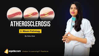 Atherosclerosis  2Minute Pathology Video  Medical Student Education  VLearning™ [upl. by Fayre]