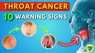 Spotting Throat Cancer Early 10 Warning Signs You Should Know  Throat Cancer Symptoms [upl. by Curry211]