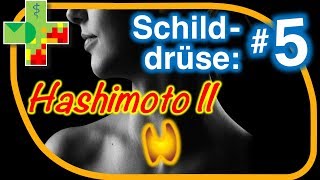 Hashimoto II Diagnostik  was ist zu beachten [upl. by Gnaw22]