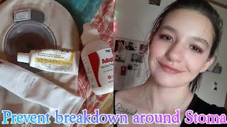 HOW TO PREVENT SKIN BREAKDOWN around STOMA Ostomy [upl. by Aihsenek]