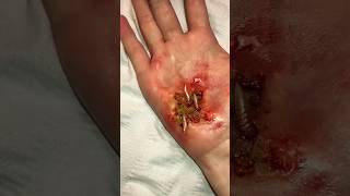 🪱 A worm eating the flesh of my hand Is it fake halloween sfxmakeup sfx youtubeshorts foryo [upl. by O'Donovan406]