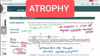 Atrophy Pathology 2  First Aid USMLE Step 1 in UrduHindi [upl. by Deirdra]