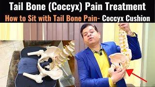 Tailbone Pain Relief Treatment Coccydynia Coccyx Seat Cushion Tail bone Exercises Sitting Pain [upl. by Mmada115]