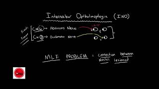 Internuclear ophthalmoplegia INO BASIC amp QUICK EXPLANATION [upl. by Ahseile]