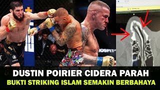 MENGERIKAN  STRIKING ISLAM MAKHACHEV BIKIN DUSTIN POIRIER CIDERA PARAH  BERITA UFC TERBARU [upl. by Laban]