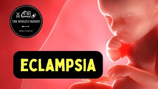 ECLAMPSIA [upl. by Iphigenia]