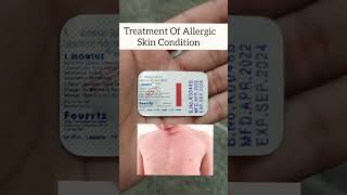 Allergy Best Medicine youtubeshorts youtube shorts [upl. by Megargee660]