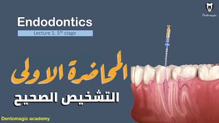 Endodontics  5th Stage Lecture One  Diagnosis in Endodontics التشخيص الصحيح لألتهاب عصب السن [upl. by Mariquilla]