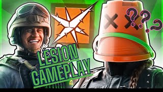 LESION NASIL OYNANIR   Rainbow six siege Türkçe  rainbowsixsiege rainbowsixsiegetürkçe gaming [upl. by Simon]