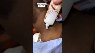 Deep Cleansing Remove Dust and Dead Skin ameenbeautytips [upl. by Aray]