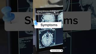 What is Schizophrenia  schizophrenia symptoms causes and Treatment schizophrenia neuroscience [upl. by Filler994]