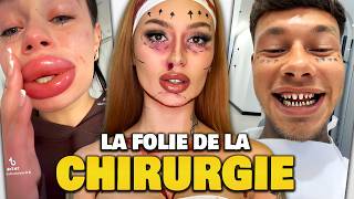 Gen Z  La génération accro à la Chirurgie Esthétique ça fait peur… [upl. by Malcah]