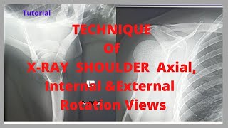 Technique of Shoulder joint Axial viewEp30  Shoulder internal amp external rotation view tutorial [upl. by Idnil530]