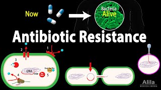 Antibiotic Resistance Animation [upl. by Leanard]