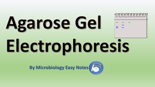 Agarose gel electrophoresis [upl. by Tesler]