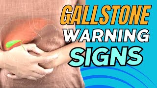 Gallbladder Disease Causes Symptoms and Effective Remedies [upl. by Attennaej141]