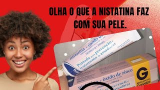 POMADA NISTATINA ÓXIDO DE ZINCO clareia virilhasaxilas acnes  espinhas  Melasma [upl. by Lerud]