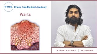 Warts  Viral Infection  Skin Disease skin skincare youtube viral medical nursing disease [upl. by Akemal73]