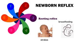 Newborn Reflexes [upl. by Dottie]