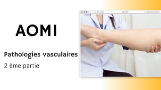 AOMI  Pathologies vasculaires 2ème partie [upl. by Osicran]