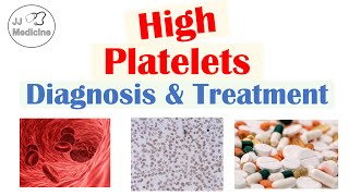 What is Thrombocytosis Diagnosis amp Treatment of High Platelets  Rapid Review [upl. by Yerot]