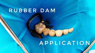 Rubber Dam Application [upl. by Dlaniger869]