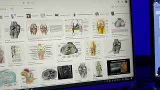 Ligamentos de la rodilla por resonancia magnética [upl. by Adriana]