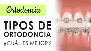 TIPOS DE ORTODONCIA  ¿BRACKETS ALINEADORES O MINI TUBOS CUÁL SERÁ MEJOR [upl. by Fachini336]