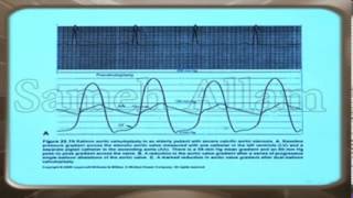 Basics of cardiac catheterization 2 [upl. by Ycart]