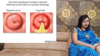 CERVICITIS  Inflammation Of Cervix  PID  Uterus Infection [upl. by Garling429]