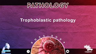 L6 Trophoblastic diseases Pathology [upl. by Iidnarb]