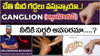 చేతి మీద గడ్డలు వస్తున్నాయా  Ganglion Causes and Symptoms Treatment in Telugu [upl. by Remark]