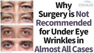 Why Under Eye Wrinkles Shouldnt be Treated with Surgery in Almost All Cases [upl. by Eibocaj]