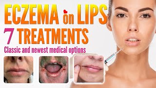 Eczema on Lips Treatment Options  How to Treat Lip Eczema Around Mouth Dermatitis [upl. by Cuttie898]