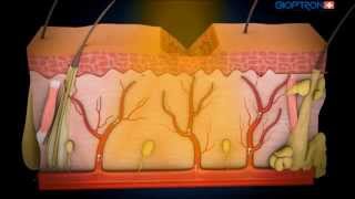 Mechanism of action phototherapy [upl. by Aynnat]