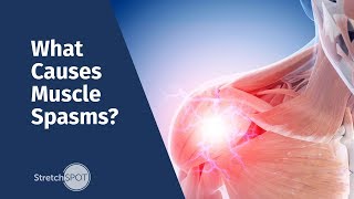 What Causes Muscle Spasms [upl. by Knitter]