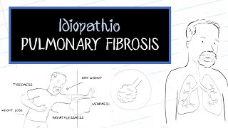 What is Idiopathic Pulmonary Fibrosis IPF [upl. by Corotto]