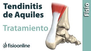 TENDINOPATÍA DEL AQUILES TENDINITIS AQUILIANA O AQUÍLEA QUÉ ES DIAGNÓSTICO TRATAMIENTO [upl. by Marla448]